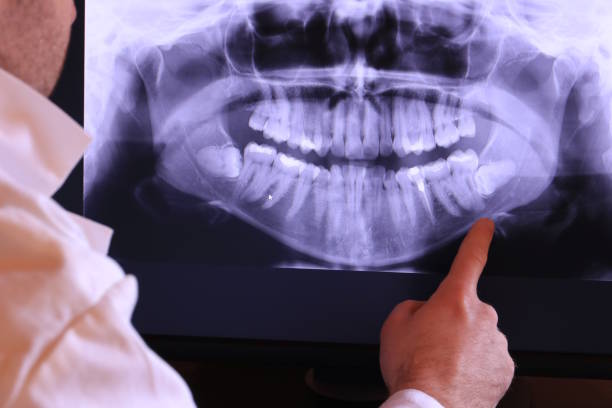 Best Cracked Tooth Emergency Dentist  in Tignall, GA